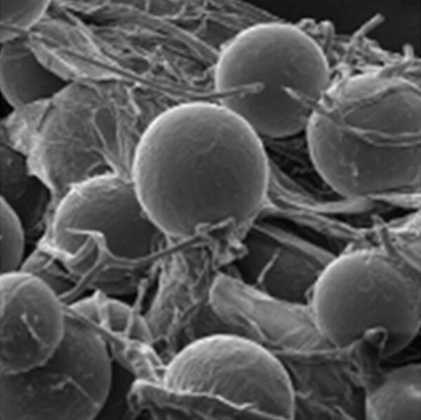 Electron microscope view of spherical mycorrhizal fungal spores