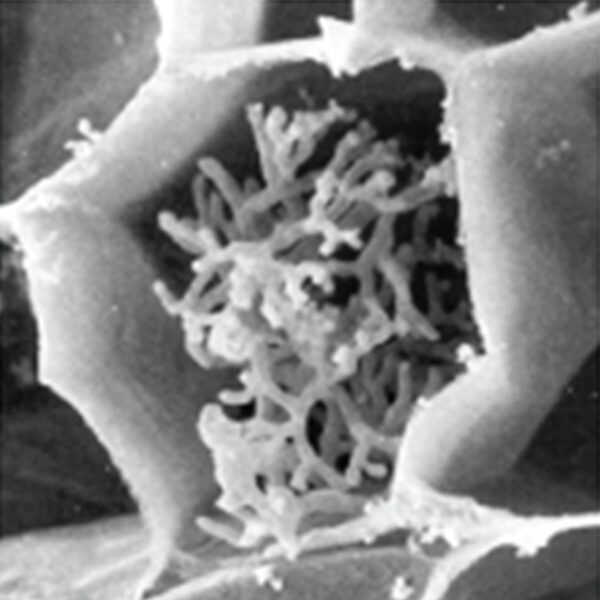 Electron microscope view of fungal hyphae threading through root tissue